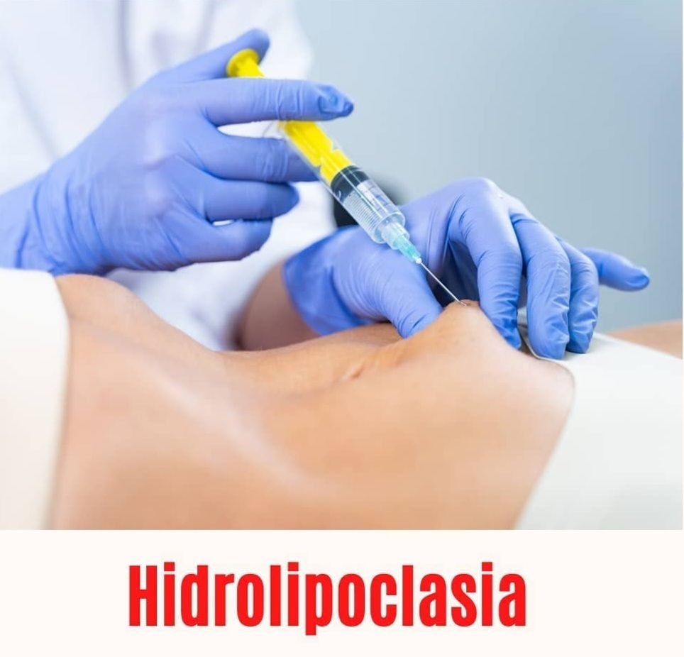 Hidrolipo