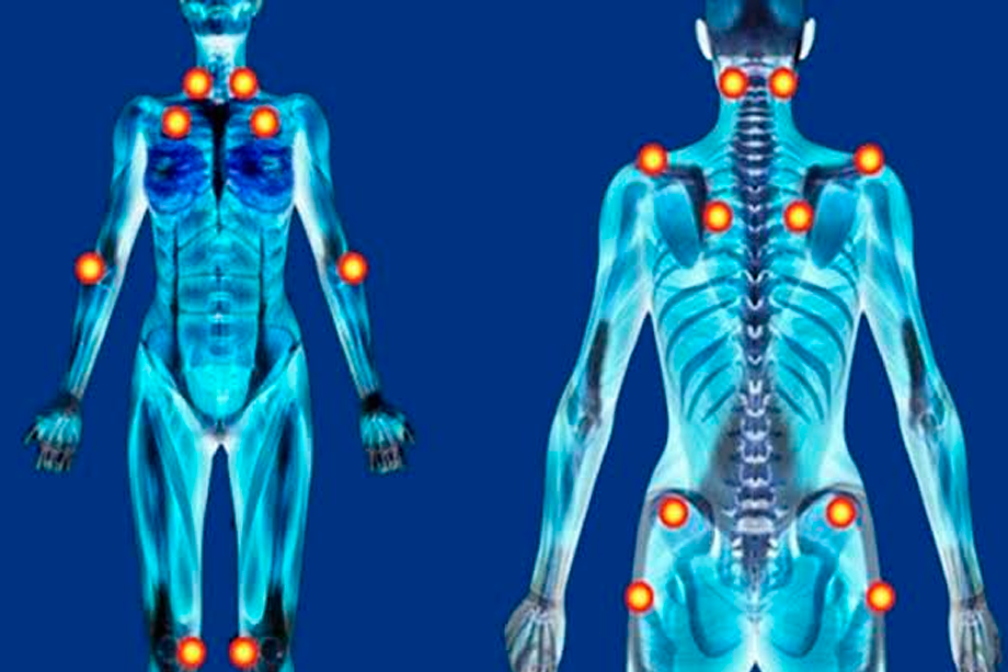 Fibromialgia - Como reduzir Dor e Desconforto