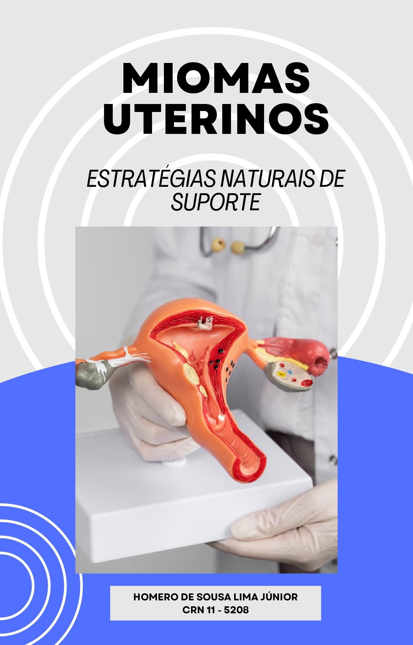 MIOMAS, ENDOMETRIOSE E SOP